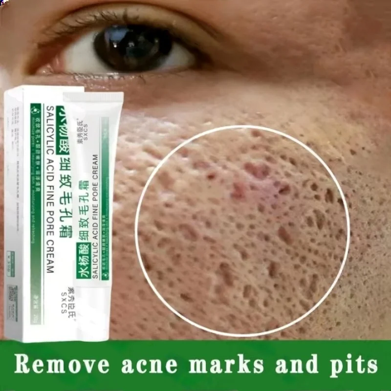 Korean Skincare Routine - Crème de nettoyage des pores à