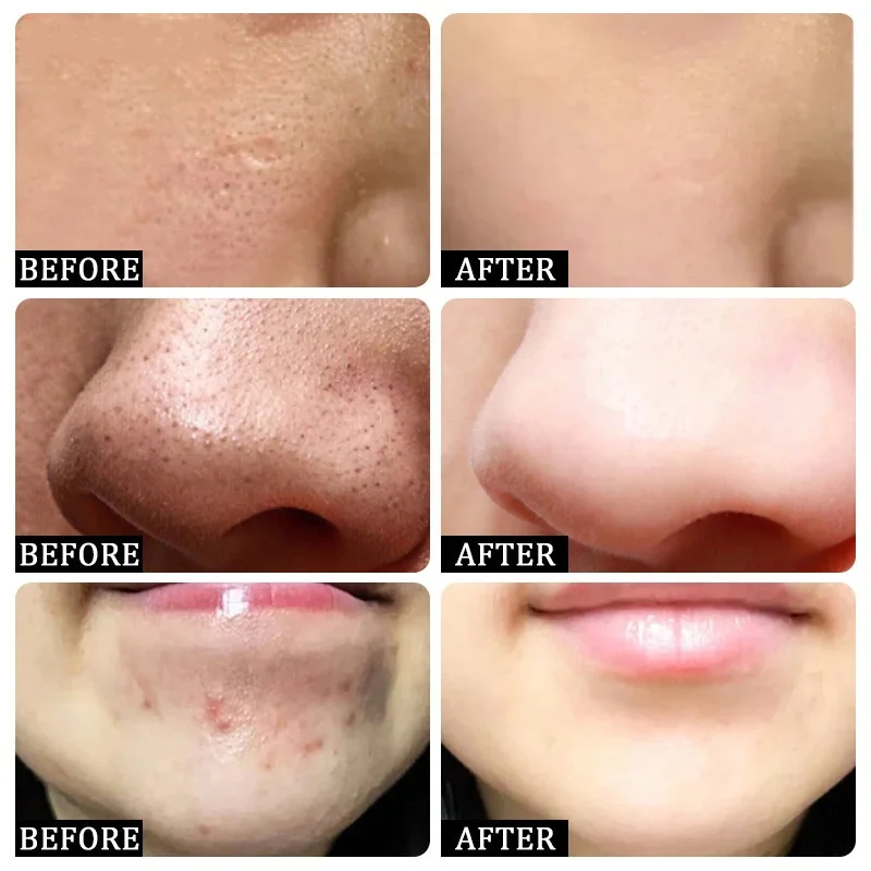 Crème de nettoyage des pores à - Korean Skincare Routine avis et prix