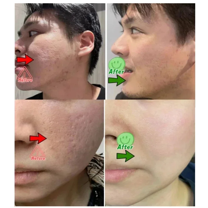 Crème de nettoyage des pores à - Korean Skincare Routine avis et prix