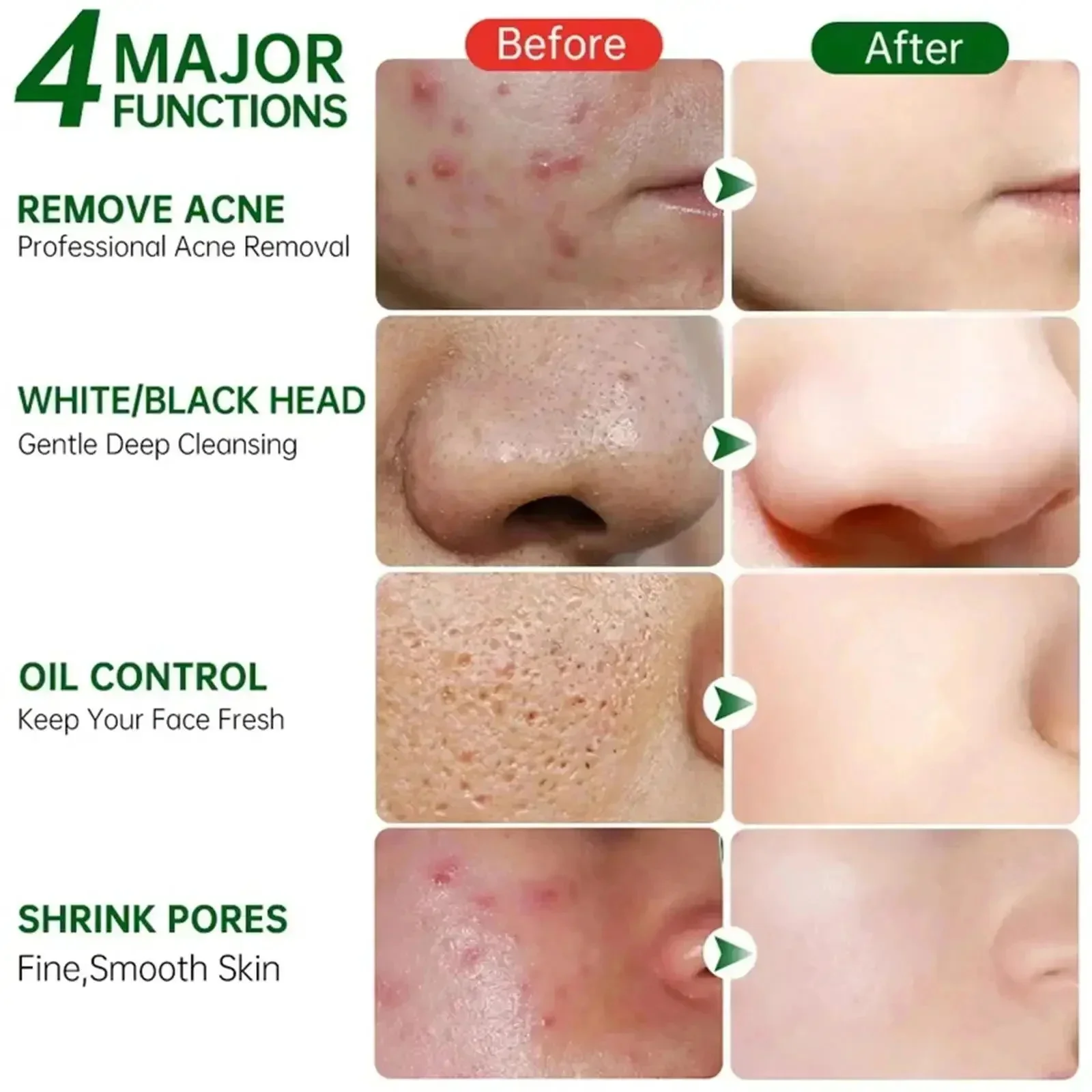 Crème de nettoyage des pores à - Korean Skincare Routine avis et prix